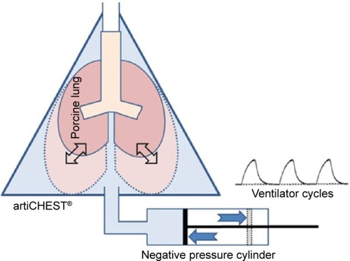 Figure 3 Illustration of the chest phantom. A porcine lung placed in the chest phantom (artiCHEST) inflates and deflates by a negative pressure cylinder.