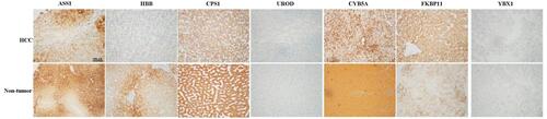 Figure 3 Representative immunohistochemical staining for seven candidate proteins (ASS1, CPS1, UROD, HBB, CYB5A, YBX1, and FKBP11) between hepatocellular carcinoma (HCC) and adjacent non-tumorous tissues. The scale bar is 500 μm.