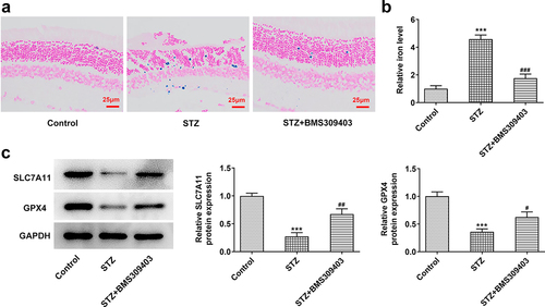 Figure 3. FABP4 inhibition reduced ferroptosis in retinal tissues in a mouse model of DR.