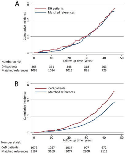 Figure 1. Kaplan-Meier failure curves estimating the cumulative incidence of the cardiovascular diseases studied in dermatitis herpetiformis (DH) patients (A, diabetes mellitus adjusted hazard ratio 1.16; 95% CI 0.91–1.47) and coeliac disease (CeD) patients (B, diabetes mellitus adjusted hazard ratio 1.36; 95% CI 1.17–1.59).