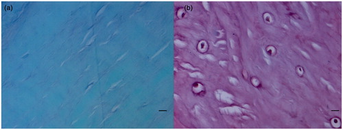 Figure 2. Histological sections of the ACL tibial insertions. Scale bars = 0.01 mm. Safranin O/fast green staining. (a) There are fusiform and spindle-shape fibroblasts and a high density of collagen bundles in ligaments stained green. (b) The fibrocartilage cells are round and ovoid in the UF region, and the area is stained red.
