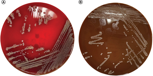 Figure 1. Culture of the vitreal sample.(A) Blood agar and (B) chocolate agar showed heavy growth of Escherichia coli.
