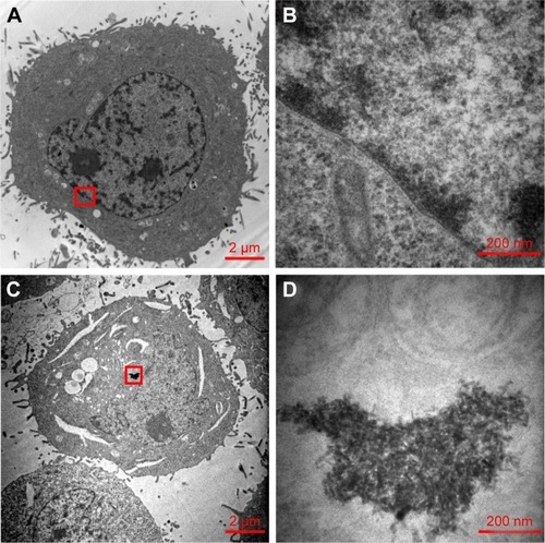 Figure 6 (A) TEM image of HepG2 in blank control. (B) Enlarged view of the marked area of panel A. (C) TEM image of HepG2 incubated with Lac-PDS/DOX@CeONR at 5 μM for 24 h. (D) Enlarged view of the marked area of panel C.Abbreviations: TEM, transmission electron microscope; PDS, dithio-polydopamine; DOX, doxorubicin hydrochloride; CeONR, CeO2 nanorod.