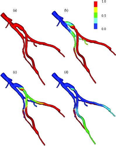 Figure 14. Scalar clearance time for AFB model. (a) The scalar field is initially set to 1.0 (shown in red) with a zero scalar Dirichlet boundary condition at the inlet. The scalar is then advected and diffused out of the flow domain over several cardiac cycles (where time is increasing from (a) until the final time point shown in (d)). The vessel walls have a scalar flux of zero.