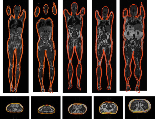 Figure 3. Segmentation of the subcutaneous fat layer from MRI scans (from left to right, increasing BMIs 19, 22, 23, 25, 35): the top row depicting coronal slices, and the bottom row depicting the manually labelled slices (yellow) and the corresponding axial slices segmented (orange) using the proposed model.