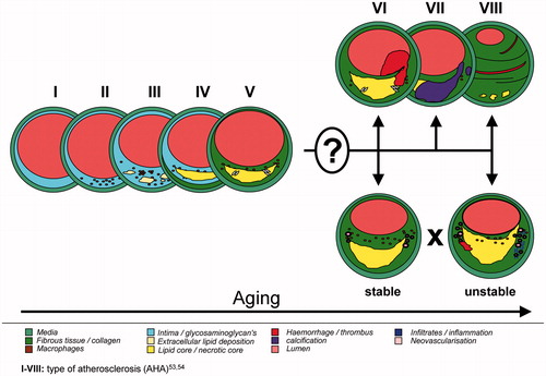 Figure 1. Plaque development during aging.