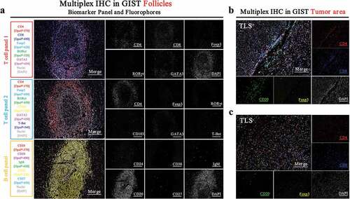 Figure 2. Immune profiles of TLS in GIST defined by multiplexed immunohistochemistry staining