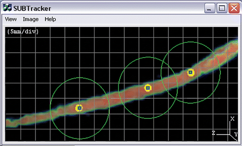 Figure 4. A 3D volume of the carotid artery of the swine filtered at 50% of the image scalar intensity range. Dots show the waypoints followed by the sphere; circles show the precision regions of radius φ. [Color version available online.]