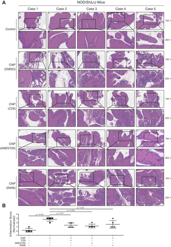 Figure 4 Hematoxylin and eosin (HE) staining displayed the variations of infiltrated inflammatory cells in response to C29, AMD3100, and R406 treatment, which targeted Toll-like receptor, Chemokine signaling pathway, and SYK pathway signalings (targeting B-cell signaling), respectively. (A) HE staining showed the inflammatory cell infiltrating status in control, CNP+DMSO treatment, CNP+C29 treatment, CNP+AMD3100 treatment, and CNP+R406 treatment groups. (B) Quantification analysis showed the inflammatory score variations between groups.