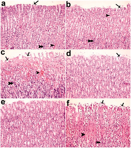 Figure 6. Histological appearance of gastric mucosa. Nearly normal mucosa view, okra 500 (a) and okra 250 (b); Hemorrhage, epithelial ulceration and very edema okra 100 (c); Decreases ulceration, hemorrhage and inflammation (d) Fam 20 and (e) Que 75 groups; Very epithelial ulceration, hemorrhage, inflammation and edema (f) Ethanol group. (H&E; Magnifications: 200×). Thin Arrows: epithelial ulceration; arrow-heads: Hemorrhage; Thick arrows: Inflammatory cells.