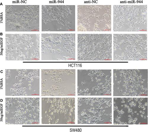 Figure 1 Cell morphology in miR-944, anti-miR-944, and corresponding negative control infected HCT116 and SW480 cells with or without EGF (50 ng/mL) treatment. (A and C) BSA treatment, (B and D) EGF treatment. The fibroblastoid-like phenotype in HCT116 (A and B) and SW480 (C and D) weakened miR-944 group cells compared with the scramble group. Anti-miR-944 had the opposite effect.