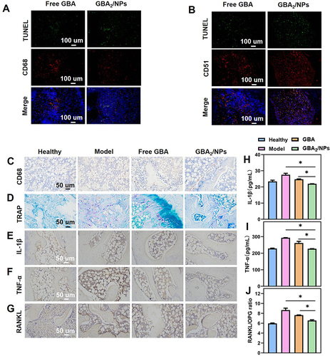 Figure 7 Pro-apoptotic effects of GBA2/NPs in macrophages and osteoclasts in AIA rats. (A and B) Detection of apoptotic cells in ankle joints from AIA rats by TUNEL assay. Determination of macrophages and osteoclasts in ankle joints from AIA rats by immunofluorescence analysis of (A) CD68 and (B) CD51, respectively. Immunohistochemical analyses of (C) the CD68-stained synovial macrophages and (D) TRAP-stained osteoclasts in the joint tissues from rats subjected to the indicated treatment. Detection of (E) IL-1β, (F) TNF-α, and (G) RANKL expression levels in arthritic joints. The serum level of (H) IL-1β, (I) TNF-α, and (J) RANKL/OPG. *p < 0.05 indicated the significant difference.