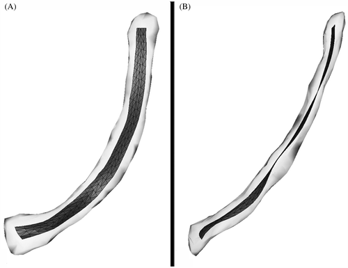 Figure 3. The mean ROI form (dark grey) is visualized within an envelope (light grey) containing all 198 homologous ROI forms. (A) Anterior-posterior (inlet) view. (B) Lateral view.