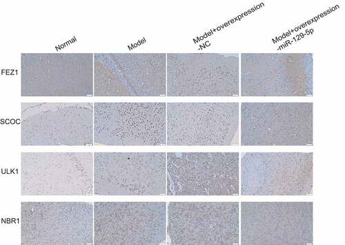 Figure 9. Immunohistochemical detection of the protein expressions of FEZ1, SCOC, ULK1 and NBR1 in mouse hippocampus of the normal, model, model + control virus, and model + overexpressing miR-129-5p virus groups.