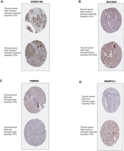 Figure 9 Validation of 4 hub genes in the translational level. (A–D) Validation of 4 hub genes by The Human Protein Atlas database (IHC).