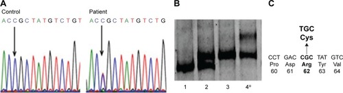 Figure 4 Genetic analysis of a patient with PSEN2 R62C.