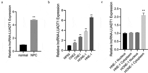 Figure 1. lncRNA-LUADT1 expression levels in tissues and cells of nasopharyngeal carcinoma patients