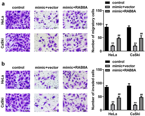 Figure 12. Over-expressed RAB8A inverted the effects of miR-613 mimic on the metastasis of the CC cells. A-B After RAB8A and miR-613 mimic transfection, the migration and invasion of the CC cells were determined with transwell assay. **P < 0.01 VS control group. ##P < 0.01 VS miR-613 mimic+vector group.