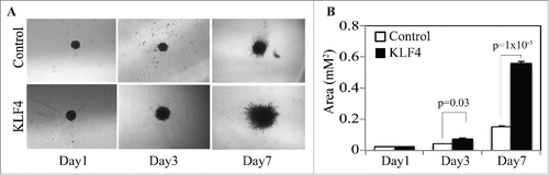 Figure 4. KLF4 promotes ESCC invasion. (A) In 3-dimensional spheroid culture, HCE4 ESCC cells expressing KLF4 invaded more into surrounding matrix that control cells. (B) Indicative of increased cancer cell invasion, HCE4 spheroids that expressed KLF4 were significantly larger at 3 and 7 days, compared to control spheroids (n = 4 for each experimental condition at each time point).