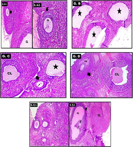 Figure 5. Histopathological examination of the ovary in different groups: A) Control group showing the antral follicle (thick arrow) and corpus luteum (CL) (Figure A1). The follicle shows healthy granulosa cells, zona pellucida (double arrow) and oocyte (thin arrow) within the follicular antrum (FA) (Figure A2). B) PCOS-IR model group showing multiple follicular cysts (stars) with absent corpus luteum. C) MET-treated group showing the antral follicle (thick arrow) with oocyte (thin arrow) and its follicular antrum. The corpus luteum (CL) reappears but with irregular luteal cells compared to the control. A cystic follicle (star) is also seen. D) SeNPs-treated group showing antral follicle (thick arrow) with oocyte (thin arrow) but with scanty follicular antrum (FA). The corpus luteum (CL) reappears but with irregular luteal cells. E) SeNPs + MET-treated group showing multiple primary follicles (white arrows) (Figure A1). The antral follicle (thick arrow) with oocyte (thin arrow), zona pellucida (double arrows) and its follicular antrum (FA). The corpus luteum (CL) is also seen (Figure A2). All slides are H&E stained. Magnification: × 200.