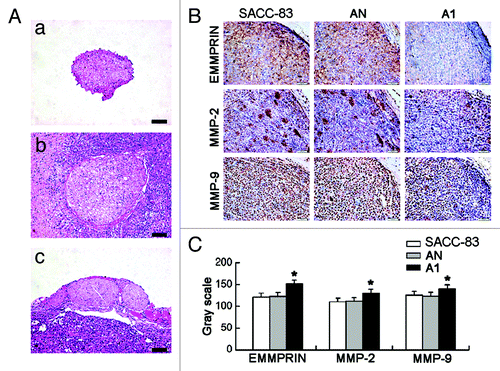 Figure 6. EMMPRIN silencing inhibits the tumor PNI and the expression of EMMPRIN, MMP-2 and MMP-9 in vivo. (A) Tumors and affected sciatic nerves were excised for H&E analysis 5 weeks after tumor implantation. (a) Normal right sciatic nerve; (b) tumor PNI caused serious swelling of the left nerve in SACC-83 and AN groups; (c) the tumor constricted nerve caused moderate swelling of the left nerve in A1 group. Bar, 200 μm. (B) Immunohistochemical staining of EMMPRIN, MMP-2 and MMP-9 in the tumors of three groups (magnification × 400). (C) Gray scale analyses of the positive staining intensity. A lower gray scale value represents a stronger positive staining. *p < 0.01.