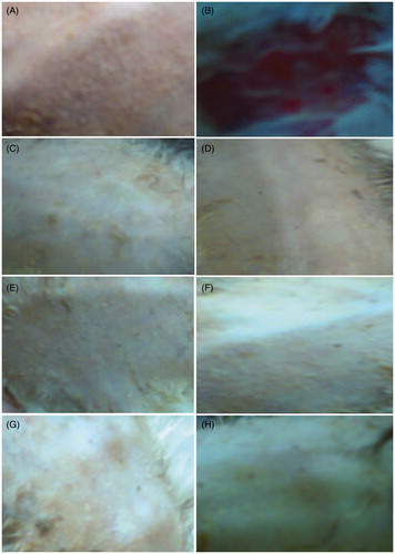 Figure 6. Representative images of Draize test on rabbit dorsal skin. (A) Untreated skin. (B) SLS. (C) Blank gel. (D) Drug solution. (E) ELA-3 gel. (F) ELA-2. (G) ELL-3. (H) ELP-3.