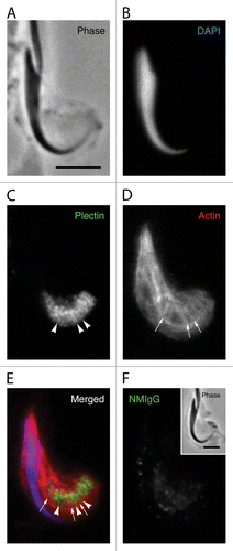 Figure 6. Plectin localization in apical Sertoli cell processes. The position of the spermatid head in the apical process is visible in the phase image (A) and when the DNA is labeled with DAPI (B). The probe for plectin reacts with material in the apical process that appears to form a network adjacent to the concave face of the spermatid head (C). Visible within this network are more concentrated bars of staining (arrowheads in C) that appear to lie between the tubulobulbar complexes as indicated by the actin probe (arrows in D). This alternating actin and plectin pattern is evident when the channels are merged (E). A staining pattern similar to that in material treated with the probe for plectin is absent when the primary antibody is replaced with normal mouse IgG (F). Bars = 5.0 μm.