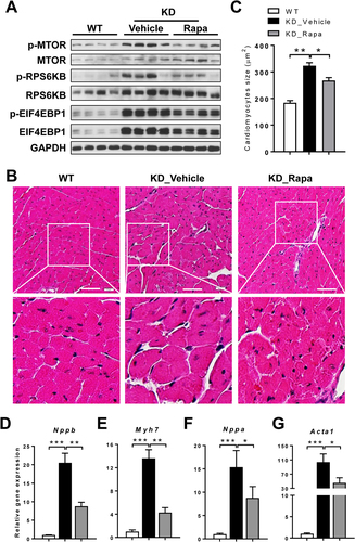 Figure 4. Rapamycin attenuates cardiomyocyte hypertrophy through inhibition of MTORC1 signaling. (A) Western blot analysis of MTORC1 signaling pathways in the heart of WT and TAFAZZIN KD mice fed with control or rapamycin diet. (B) H&E staining of the LV sections of WT and TAFAZZIN KD mice. Scale bar: 40 μm. (C) Quantitative analysis of cardiomyocytes size of WT and TAFAZZIN KD mice fed with control or rapamycin diet. n = 3 mice per group, 100 cells per mouse were used for quantification analysis. (D-G) qRT-PCR analysis of mRNA levels of major biomarkers associated with hypertrophic cardiomyopathy, including Nppb (D), Myh7 (E), Nppa (F), and Acta1 (G) in the heart of WT and TAFAZZIN KD mice fed with control or rapamycin diet. Data are represented as mean ± SD. *p < 0.05, **p < 0.01, ***p < 0.001 by one-way ANOVA.