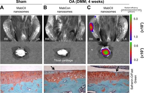 Figure 4 Localization of targeted nanosomes in DMM mice.Notes: (A) The treatment of targeted nanosome in a mouse that has been subjected to sham surgery of the right knee resulting in no joint damage. (B) and (C) Mice subjected to surgical DMM. The mice in columns (A) and (C) received an injection of MabCII nanosome, and the mouse in column (B) was injected with MabCon nanosome (nontargeted). Significant nanosome binding is only seen in damaged knee of DMM mouse injected with targeted nanosomes (C). Black arrow indicates the damaged cartilage surface as evident by the loss of proteoglycans.Abbreviations: DMM, destabilization of the medial meniscus; MabCII, monoclonal anti-type II collagen antibodies; MabCon, control antibodies, same subclass mouse IgG; OA, osteoarthritis; RK, right knee joint; LK, left knee joint.