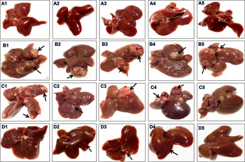 Figure 11 Effect of the tested compounds on the morphological aspect of livers. Representative photographs of livers from the control (A1–5) group showed normal morphological aspects. Liver from the DENA group (B1–5) showed faint red irregular rough surface and mostly loose consistency. Liver from the SFN-treated group (C1–5) showed firm consistency with irregular rough surface incorporating some scattered micronodules (arrows) of different sizes throughout the liver. Livers in the CNTs-SFN-MCs -treated group (D1–5) showed relatively normal morphological aspects.