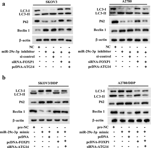 Figure 6. miR-29c-3p controls autophagy by regulating FOXP1/ATG14 pathway. (a) The DDP-sensitive cell lines (SKOV3 and A2780) were divided into the NC, miR-29c-3p inhibitor, miR-29c-3p inhibitor + si-control, miR-29c-3p inhibitor + si-FOXP1, and miR-29c-3p inhibitor + si-FOXP1 + pcDNA-ATG14 groups. Then the cells were treated with rapamycin, which is an agonist of autophagy. The expression of autophagy-related proteins was detected using Western blot assay. (b) The DDP-resistant cell lines (SKOV3/DDP and A2780/DDP) were divided into the pre-NC, miR-29c-3p mimic, miR-29c-3p mimic + pcDNA, miR-29c-3p mimic + pcDNA-FOXP1, and miR-29c-3p mimic + pcDNA-FOXP1 + si-ATG14 groups. Then the cells were treated with 3-MA, which is an antagonist of autophagy. The expression of autophagy-related proteins was detected using Western blot assay. Three independent experiments with biological repeats