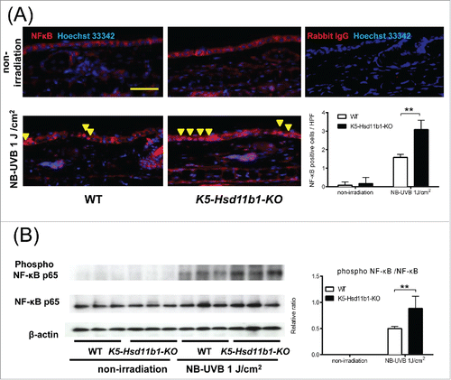Figure 4. NB-UVB-induced activation of NF-κB in the K5-Hsd11b1-KO mouse skin was enhanced. (A) Immunofluorescence staining of NF-κB p65 (red) and nuclei (Hoechst 33342, blue) in skin of 2-month-old WT and K5-Hsd11b1-KO mice 3 hours after NB-UVB irradiation at 1 J/cm2. Rabbit IgG was used as isotype control. Bar = 100 μm. Three sections from each mouse were evaluated. The bars indicate the number of NF-κB p-65-positive cells translocated into the nucleus after NB-UVB irradiation (mean ± SD; N = 6; **P < 0.01, two-way ANOVA followed by the Bonferroni-Dunn test for multiple comparisons).  (B) Western blot analysis of the phospho-NF-κB p65 expression in skin from 2-month-old WT and K5-Hsd11b1-KO mice 1 hour after NB-UVB irradiation at 1 J/cm2. The intensity of the bands was quantified using the NIH Image J software program. The phospho-NF-κB p65/NF-κB p65 was calculated. The bars indicate the mean ± SD (N = 3; *P < 0.05, 2-way ANOVA followed by the Bonferroni-Dunn test for multiple comparisons).