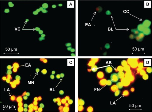 Figure 3 Fluorescent micrographs of acridine orange/propidium iodide double-stained Jurkat cells treated with Fe3O4 MNPs. (A) Untreated cells showing normal cell structure, (B) early apoptotic cells after 24 hours of treatment showing membrane blebbing and chromatin condensation, (C) blebbing and nuclear margination after 48 hours of treatment, and (D) DNA fragmentation and apoptotic body formation after 72 hours of treatment.Abbreviations: VC, viable cells; EA, early apoptotic cells; CC, chromatin condensation; BL, membrane blebbing; MN, marginated nucleus; FN, fragmented nucleus; LA, late apoptotic cells; AB, apoptotic body; Fe3O4 MNPs, magnetic iron oxide nanoparticles; DNA, deoxyribonucleic acid.