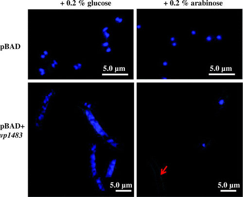 Fig. 1. Microscopic analysis of E. coli cells repressing or expressing vp1843.