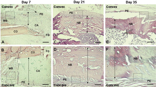 Figure 2. Hematoxylin and eosin (H & E) staining (A-F) showing changes in bone thickness on the convex (anterior) side (A, C, and E) and the concave (posterior) side (B, D, and F) of the angulated fracture at day 7 (A and B), 21 (C and D), and 35 (E and F) after fracture. The arrows depict the thickness of woven bone or new bone, showing intensive bone formation on the concave side at early phases of fracture healing (days 7 and 21) and intense reduction of bone thickness on the convex side at a later phase of fracture healing (day 35). The small dotted square in each panel depicts the observed area of NPY immunostaining (20×) shown specifically in Figures 4 and 5. 2× objective. Bar represents 1,000 μm. CA: cartilaginous callus; CO: cortical bone; FG: fracture gap; NB: new bone; PE: periosteum; WB: woven bone.