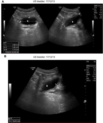 Figure 2 Images of urinary tract.