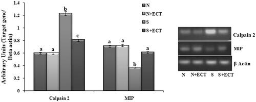 Figure 4. Photographic and graphical representation of mRNA expression of calpain and MIP in the lenses of different experimental groups. N: Normal; S: Selenite. Each value represents mean ± SEM of six values. Different alphabets indicate significant difference between different groups at p < 0.05. Comparison is carried out between the groups; Cataract group is compared with control group and treatment group is compared with cataract group. aindicates normal group, bindicates significantly different from normal group and cindicates significantly different from cataract group.