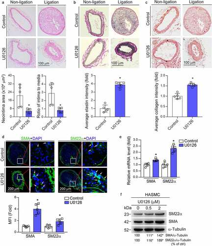 Figure 1. MEK1/2 inhibitor reduces carotid artery ligation induced neointimal formation. ApoE−/− mice were pre-fed HFD or HFD containing U0126 (3 mg/kg) for 2 weeks. Mouse left and right carotid arteries were conducted sham and ligation operation respectively, followed by feeding of HFD or HFD plus U0126 for another 4 weeks. Both left and right carotid arteries were collected and prepared cross sections for the following assays: HE staining for morphological analysis with quantitative analysis of neointima and media areas (a); VVG staining for determination of elastin content (b), sirius red staining for determination of collagen content (c), the percentage of elastin or collagen positive area in whole intima was calculated, *P < 0.05 (n = 5). (d) expression of SMA and SM22α in right carotid artery was determined by immunofluorescent staining with quantitation of mean fluorescent intensity (MFI). While arrow: positive staining. *P < 0.05 (n = 5). (e) ApoE−/− mice were conducted right carotid arteries ligation operation as described above. The mice were fed HFD or HFD plus U0126 for 1 week. Expression of SMA and SM22α mRNA in carotid artery was determined by qRT-PCR. *P < 0.05 (n = 5). (f) HASMCs were treated with U0126 at the indicated concentration for 16 h. Expression of SMA and SM22α protein was determined by Western blot. *P < 0.05 (n = 3).