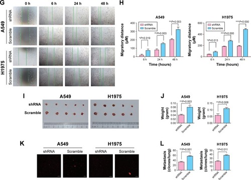 Figure 2 Inhibition of MTBP decreases invasion and migration ability of lung adenocarcinoma cells both in vitro and in vivo.