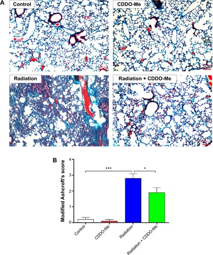 Figure 6 Effects of CDDO-Me treatment on radiation-induced collagen deposition and lung fibrosis in mice.