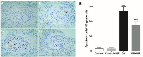 Figure 5 Effect of HIR on apoptosis in renal tissues. (A–E), TUNEL staining was used to detected the apoptotic cells in renal tissues of control (A), control + HIR (B), DN (C), and DN + HIR (D) group, and TUNEL positive cells were quantified (E). Seven rats per group and 10 visual fields for each slice for statistics. ***Indicates P < 0.001 vs control group, and ###indicates P < 0.001 vs DN group.