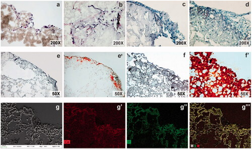 Figure 5. Cross section (16 µm) of the coated scaffolds at 7 (a), 23 (b), 35 (c) and 60 (d) days of culture in a commercial osteogenic differentiation medium (Lonza™). Sections were stained with HE staining methods. Comparison between scaffold sections stained with HE and AR at 35 (e, e′) and 60 (f, f′) days of culture in the induction medium. Calcium deposits are stained in red (e′, f′). SEM micrograph (g) and microanalysis of a section of the scaffold at 60 days of culture in induction medium. Ca mapping (g′), P mapping (g″) and overlapping image (g‴).