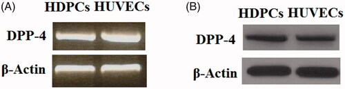 Figure 1. DPP-4 is expressed in human dental pulp cells. Human umbilical vein endothelial cells (HUVECs) were used as a positive control. (A). Reverse transcription PCR (RT-PCR) analysis of DPP-4; (B). Western blot analysis of DPP-4.