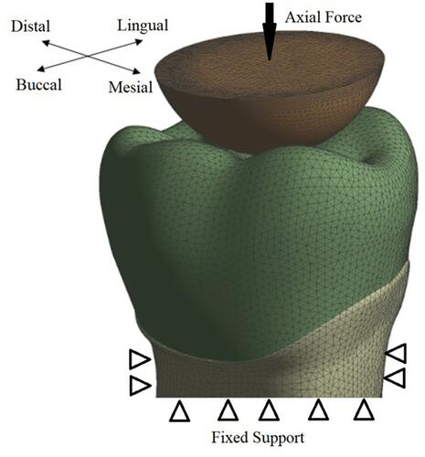 Figure 4 The boundary conditions and the direction of applied load on the crown.