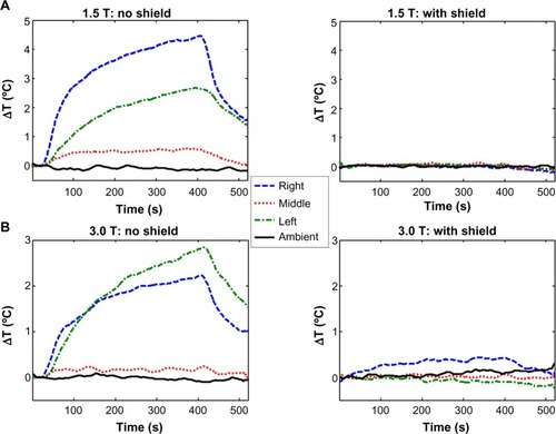 Figure 6 RF heating of metallic leads submerged in the ASTM head-and-torso phantom with and without the RF shield wrapped around the phantom and enclosing the leads: (A) 1.5 T and (B) 3.0 T.