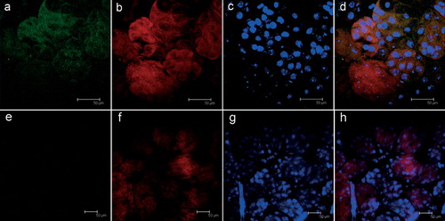 Figure 1. Indirect immunofluorescence assay (FITC-conjugated secondary antibodies) on salivary glands from Ixodes ricinus (a–d) and Ixodes hexagonus (e–h) semi-engorged adult females; (a, e) staining using polyclonal antibodies raised against the rFliD from Midichloria mitochondrii (green); (b, f) live mitochondria stained with MitoTracker Red CMXROS (red); (c, g) cellular nuclei stained for cell viability with TOTO-3 iodide; (d, h) merging of the images. In d the yellow spots indicate the overlap between M. mitochondrii (green) and mitochondria (red). Colour version available online.