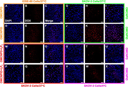 Figure 5. Cellular uptake of OMCNPD and OMCNPID. (A-L) Fluorescent images of IOSE-80 and SKOV-3 cells incubated with OMCNPD or OMCNPID, respectively. (M-R) Fluorescent images of SKOV-3 cells incubated with OMCNPD or OMCNPID with excess free I6P8 peptide. (S-X) Fluorescent images of SKOV-3 cells incubated with OMCNPD or OMCNPID at 4 °C. Bar = 100 μm.