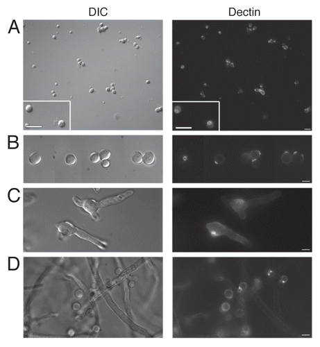 Figure 2 Dectin-1 binding on phialidic conidia and accessory conidia at different germination stages. Soluble dectin-1 binding on A. terreus phialidic and accessory conidia at (A) dormant conidia (B) swollen conidia, (C) early germ tube formation and (D) late germination. DIC and fluorescence images were captured by microscopy at 40x (A) and 100x (B–D), and are representative of 3 experiments. Within windows, arrows depict the ring-like staining pattern on AC at 100x (A). Scale bars denote 5 µm and 10 µm for 40x and 100x magnification, respectively.