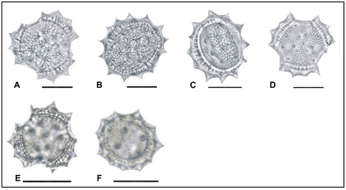 Figure 6. Light micrographs of pollen grains (×1000) Achillea pseudoaleppica (A, B) (from Arabacı 1446), (C, D) (from Arabacı 1389), (E, F) (from Arabacı 2244). Scale bars 20 μm.