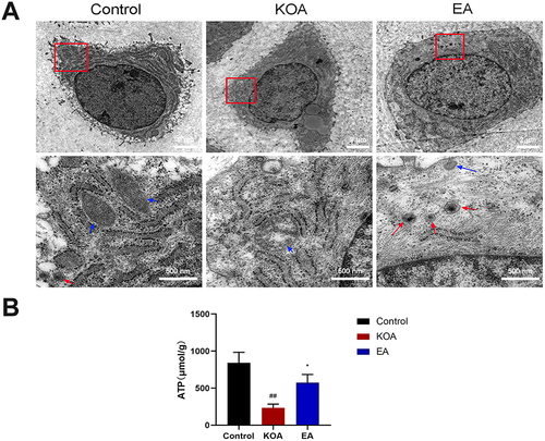 Figure 3 Effect of EA on mitochondrial morphology and function of KOA Rabbit chondrocytes. (A) TEM showed mitophagosome formation and mitochondrial morphology, red arrow represented mitophagosome, blue arrow represented mitochondria Bars:2μm in the first row; 500nm in the second row. (B) ATP level in cartilage. Values were means ± SEM; N=6. ##P < 0.01 vs Control; *P < 0.05 vs KOA.